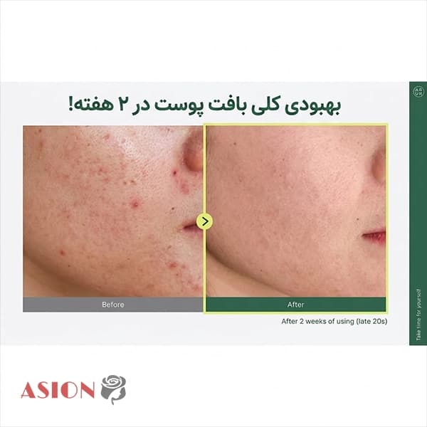 تونر تسکین دهنده heartleaf آنوا — تصویر ۵