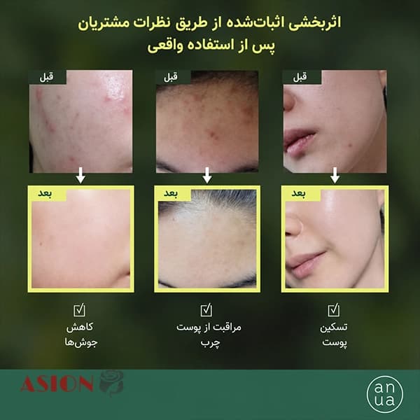 تونر تسکین دهنده heartleaf آنوا — تصویر ۶