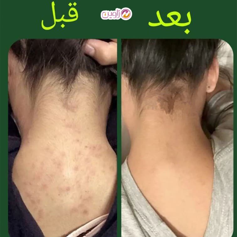 سرم لایه بردار بدن سلاوی 30میل — تصویر ۹