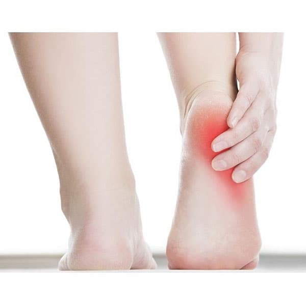 محافظ سیلیکونی پاشنه پا فوت کر مدل FOOTCARE HEEL FOOT SILICONE PROTECTOR A-034 — تصویر ۱۱