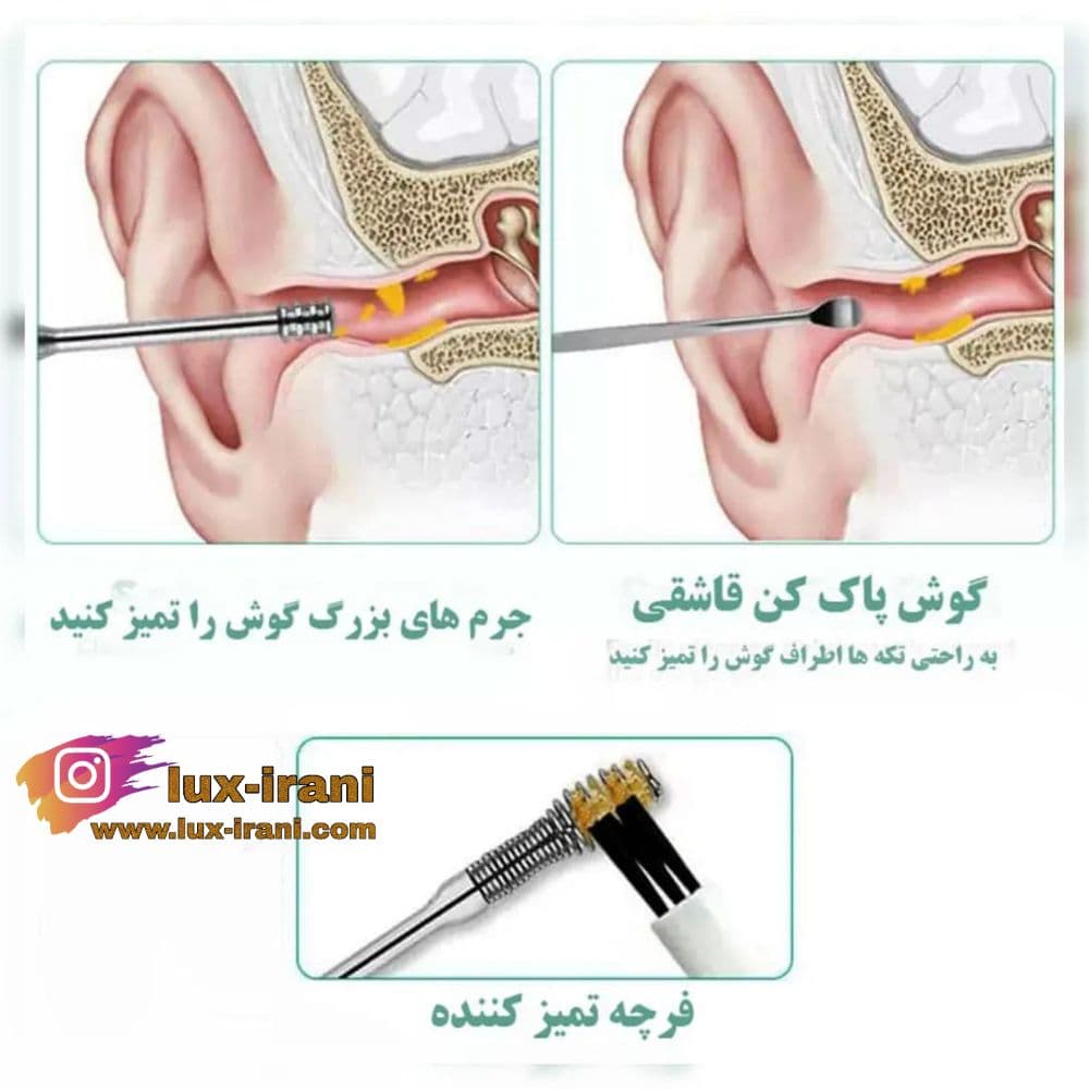 گوش پاک کن فنری — تصویر ۴