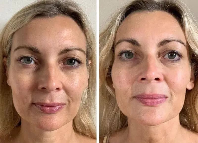 سرم جوانساز اولتیمون شیسیدو – کنسانتره اولتیمون shiseudo ultimune — تصویر ۴