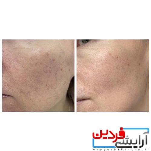 آمپول التیام بخش سنتلا اسکین 100میل SKIN1004 Madagascar Centella — تصویر ۷