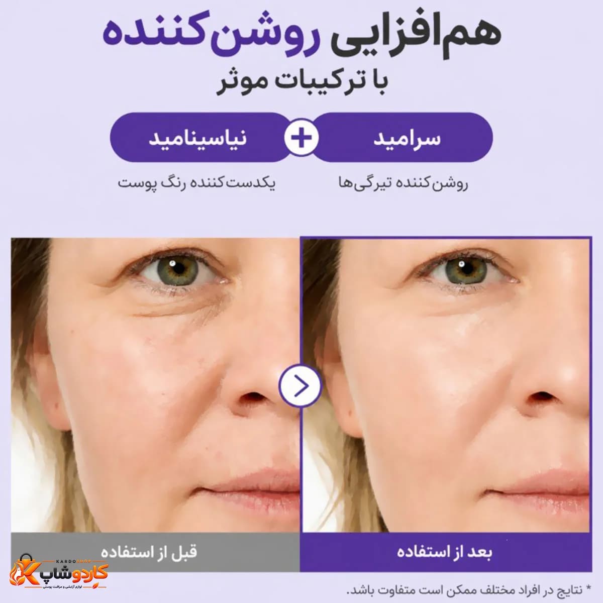 کرم دور چشم نامبوزین شماره 9 مدل NAD+ Retinal Volumetox حجم 20 گرم — تصویر ۷