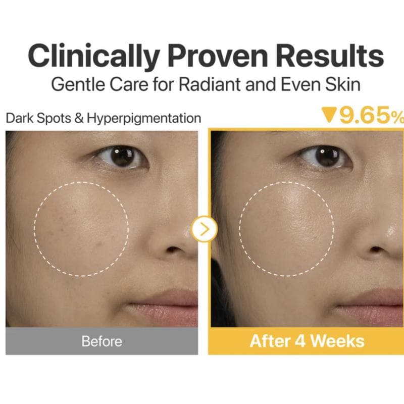 سرم ضد لک ویتامین سی نامبوزین Vitamin C Serum حجم 30 میلی لیتر — تصویر ۷