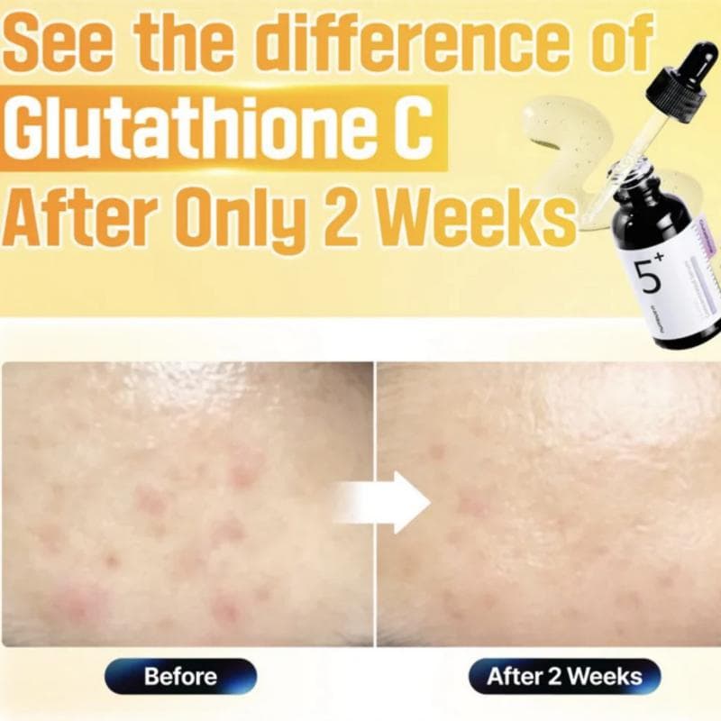 سرم ضد لک ویتامین سی نامبوزین Vitamin C Serum حجم 30 میلی لیتر — تصویر ۲