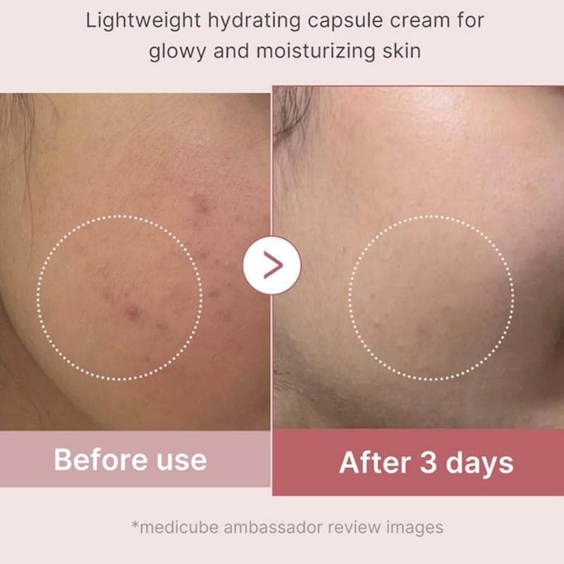کرم کپسولی کلاژن مدی کیوب Collagen Capsule حجم 55 گرم — تصویر ۸