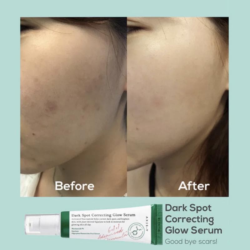 سرم ضد لک اکسیس وای Dark Spot حجم 50 میلی‌لیتر — تصویر ۲
