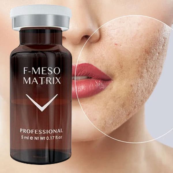 کوکتل درمان ترک پوستی و اسکار فیوژن F-MESOMATRIX — تصویر ۱۲