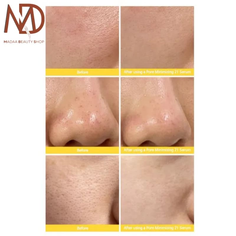 سرم منافذ تیام حجم 40 میل | TIAM Pore Minimizing 21 Serum — تصویر ۱۰
