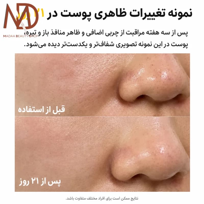 سرم منافذ تیام حجم 40 میل | TIAM Pore Minimizing 21 Serum — تصویر ۴