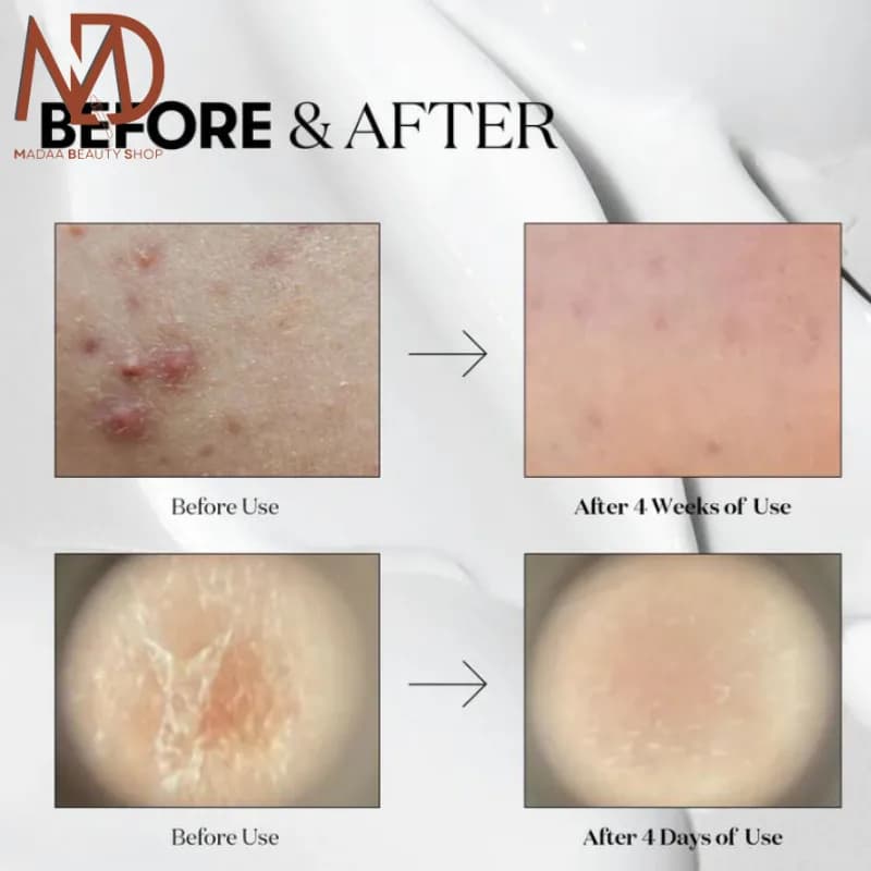 سرم ریدل شات 100 وی تی حجم 50 میل | VT Cosmetics Reedle Shot 100 — تصویر ۱۰