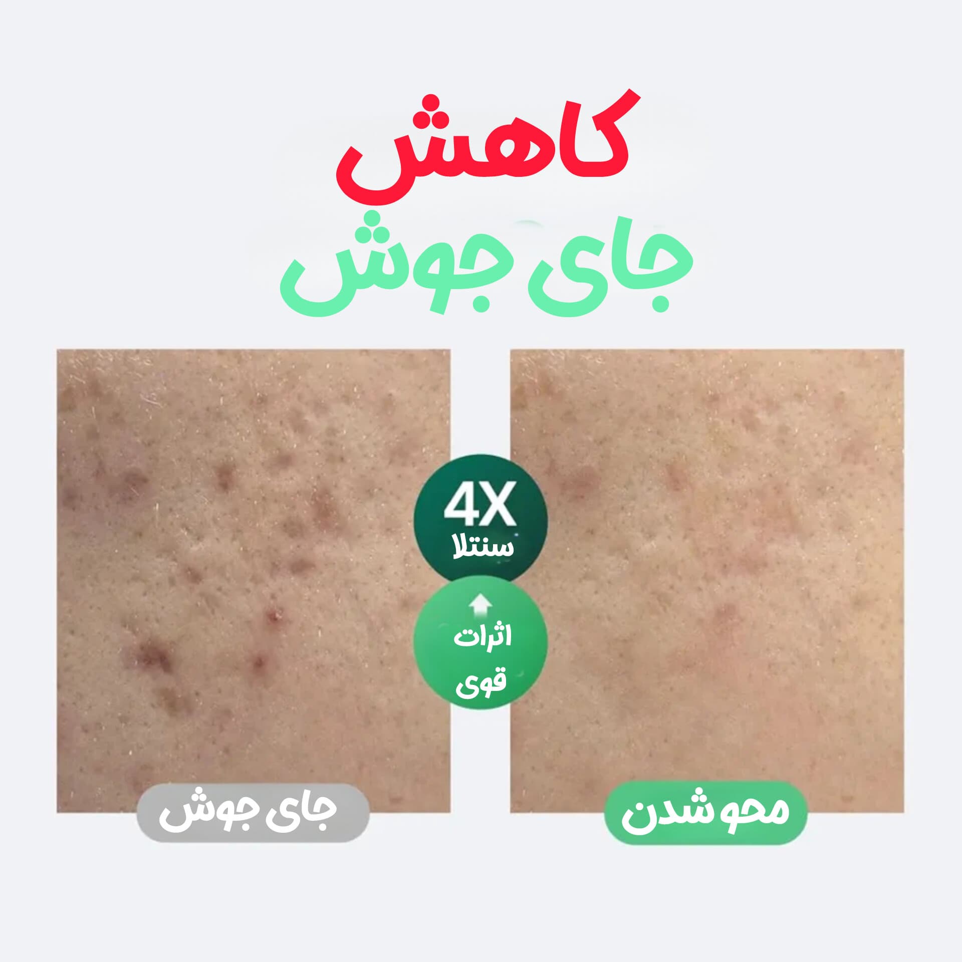 سرم تسکین دهنده سنتلا پیوریتو — تصویر ۹