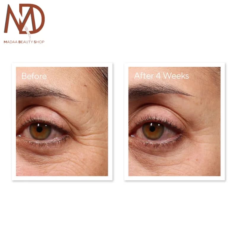 سرم دور چشم رتینول موراد حجم 15 میل | Murad Retinol Youth Renewal Eye Serum — تصویر ۳