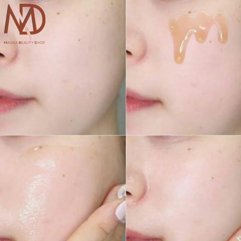 سرم ترمیم کننده هایجی نچرال ریپر 30 میل | HYGGEE Natural Repair Serum — تصویر ۶