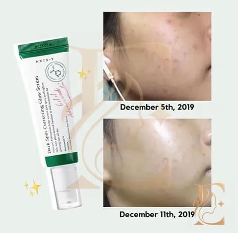 سرم ضد لک و روشن کننده اکسیس وای | Axis-Y Dark Spot Correcting Glow Serum — تصویر ۵