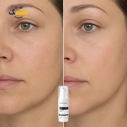 سرم آبرسان قوی استادرم Intensive Hyaluronic حجم 40 میلی‌لیتر — تصویر ۴
