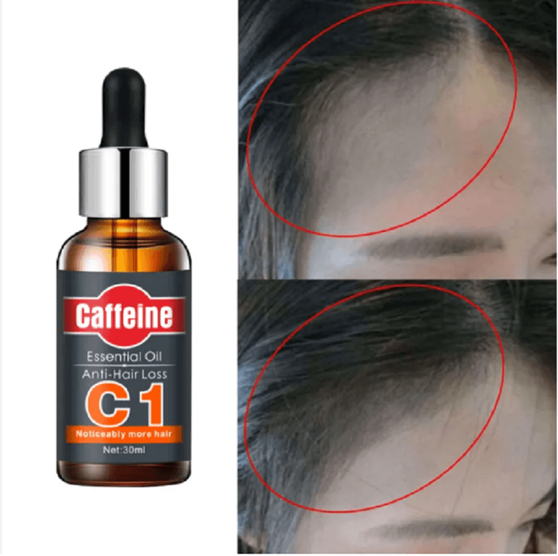 سرم تقویت و ضد ریزش مو کافئین Caffeine مدل C1 — تصویر ۱۱