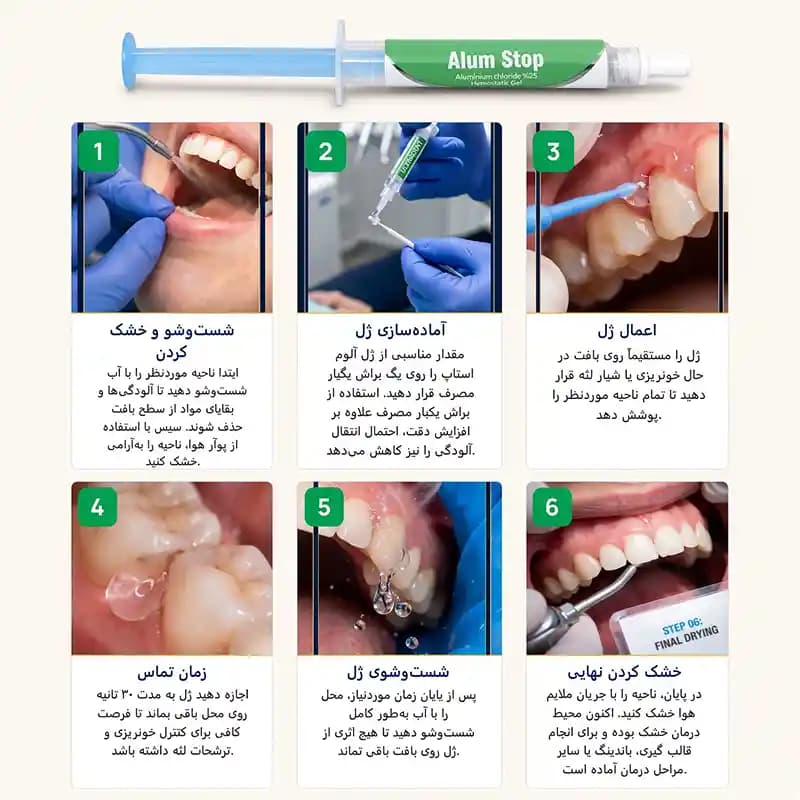 ژل هموستات انعقاد خون مروابن Alum Stop Morvabon — تصویر ۴