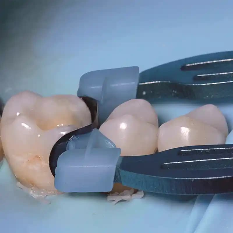 کلمپ اتومات دی دی اس دنت DDS Dent Auto Clamp — تصویر ۲