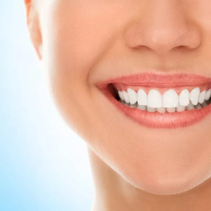 مسواک اورتودنت مدل آنتی باکتریال با برس خیلی نرم — تصویر ۵