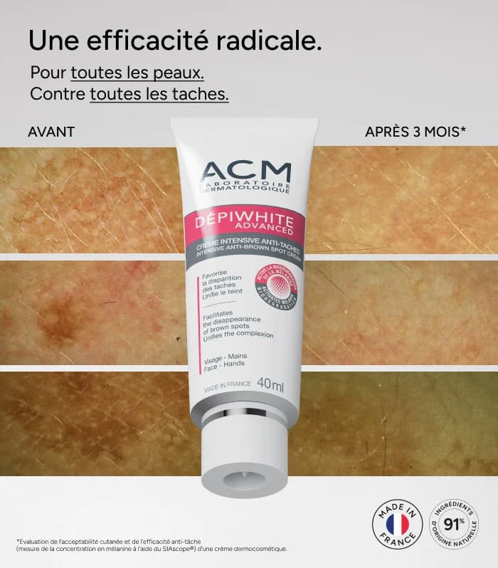 کرم ضد لک ACM — تصویر ۱۱
