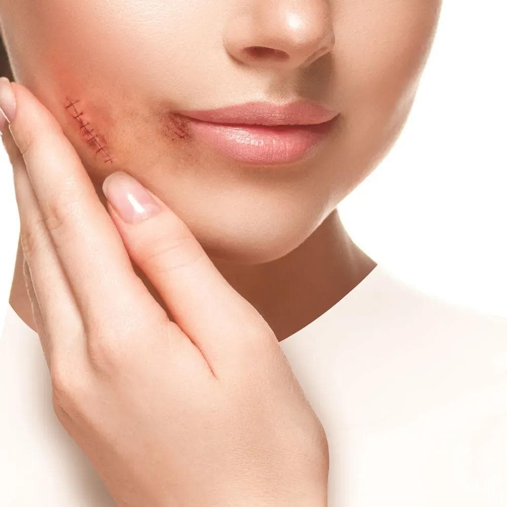 کرم ترمیم کننده ژیناژن — تصویر ۶