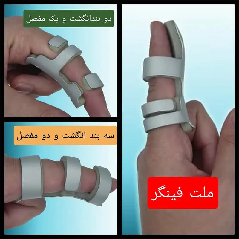 آتل انگشت آلومینیومی سایز ۱ — تصویر ۵