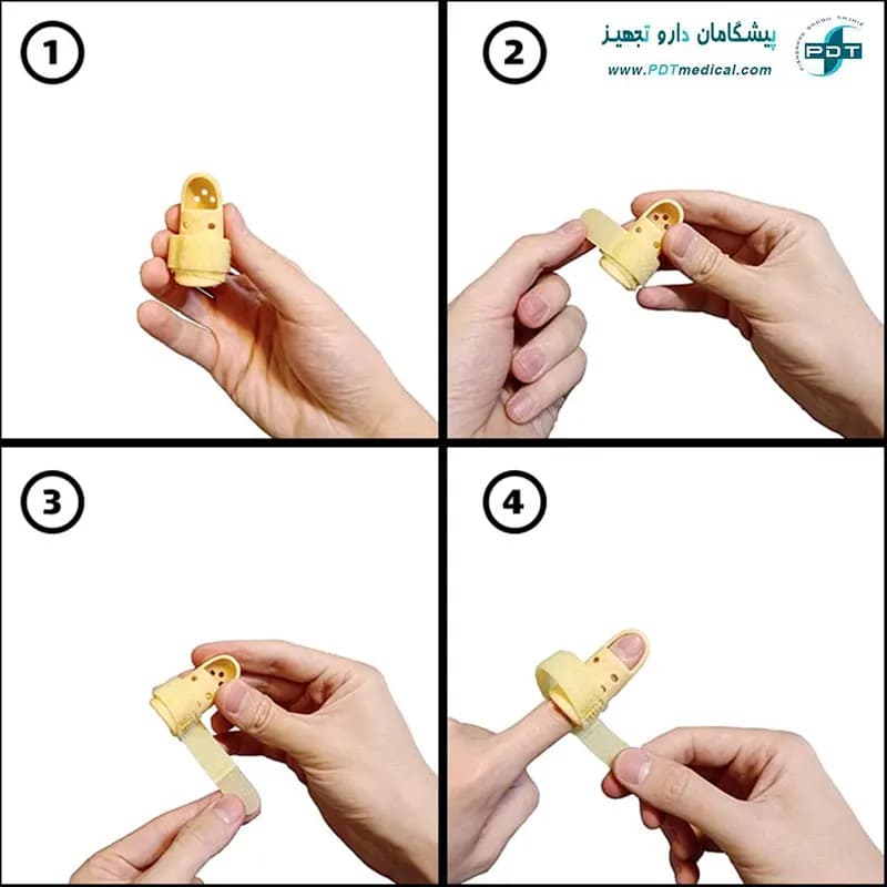 آتل انگشت ملت فینگر — تصویر ۶