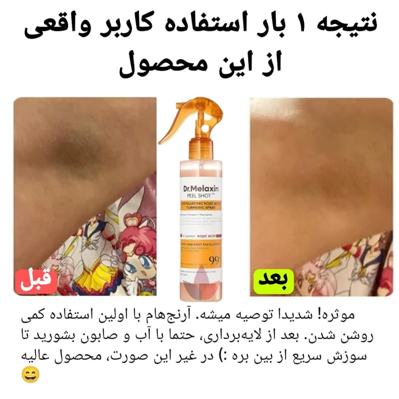اسپری روشن کننده و لایه بردار دکتر ملاکسین — تصویر ۴