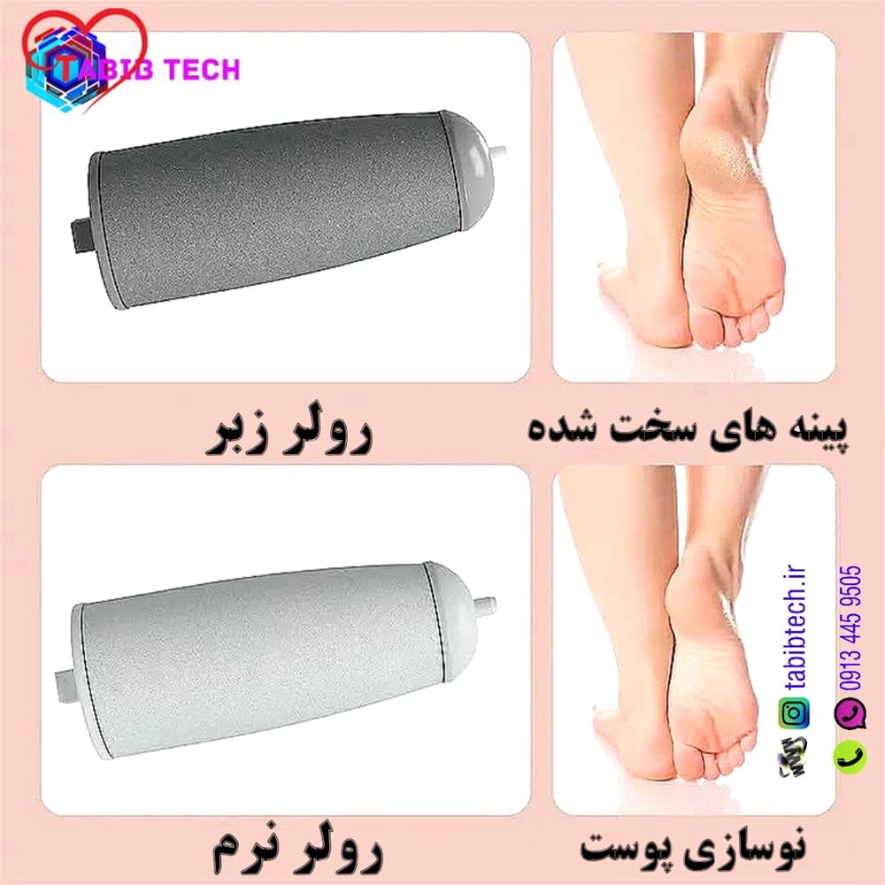 سوهان سنگ پا برقی و شارژی مدل ORG — تصویر ۱۰