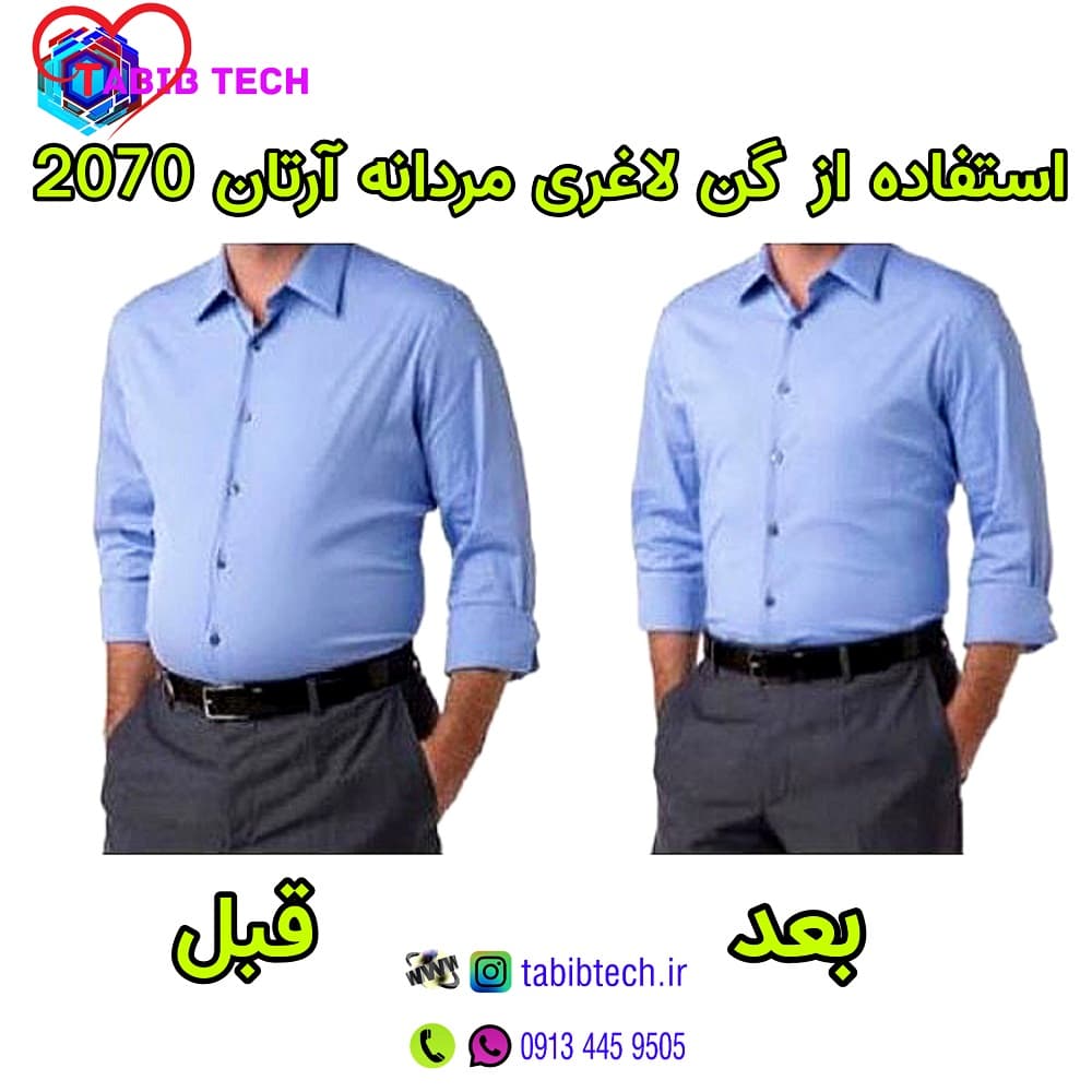 گن لاغری مردانه آرتان 2070 Artan — تصویر ۳
