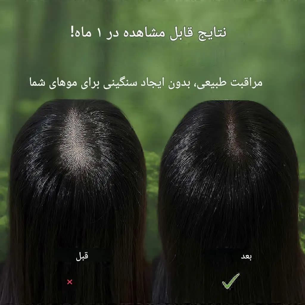شامپو بار سون هربال (صابون) گیاهی 120گرم — تصویر ۱۰