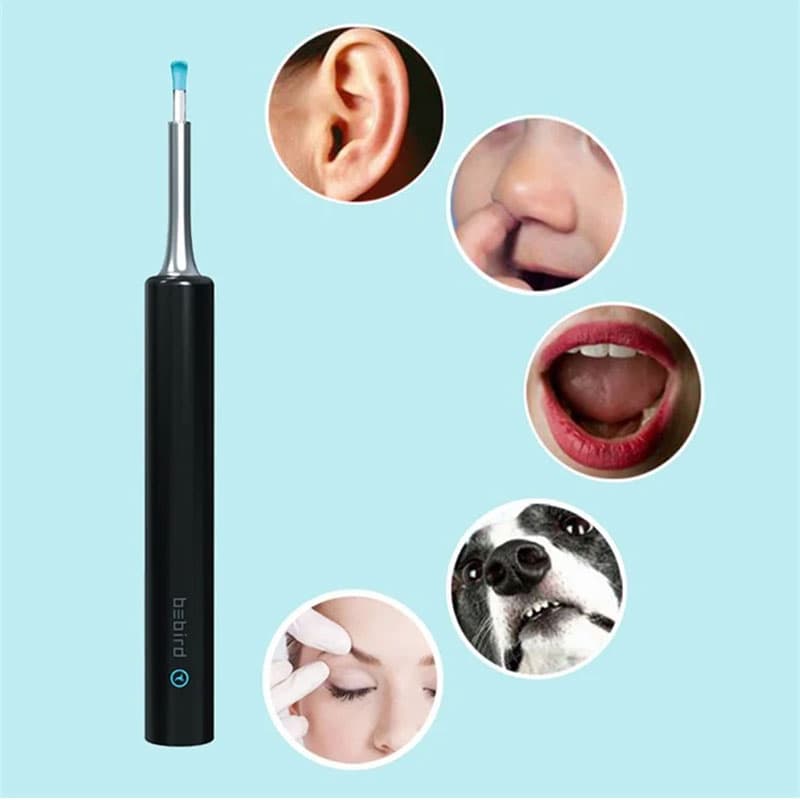 گوش پاک کن با آندوسکوپ دیجیتال BEBIRD C3 — تصویر ۴