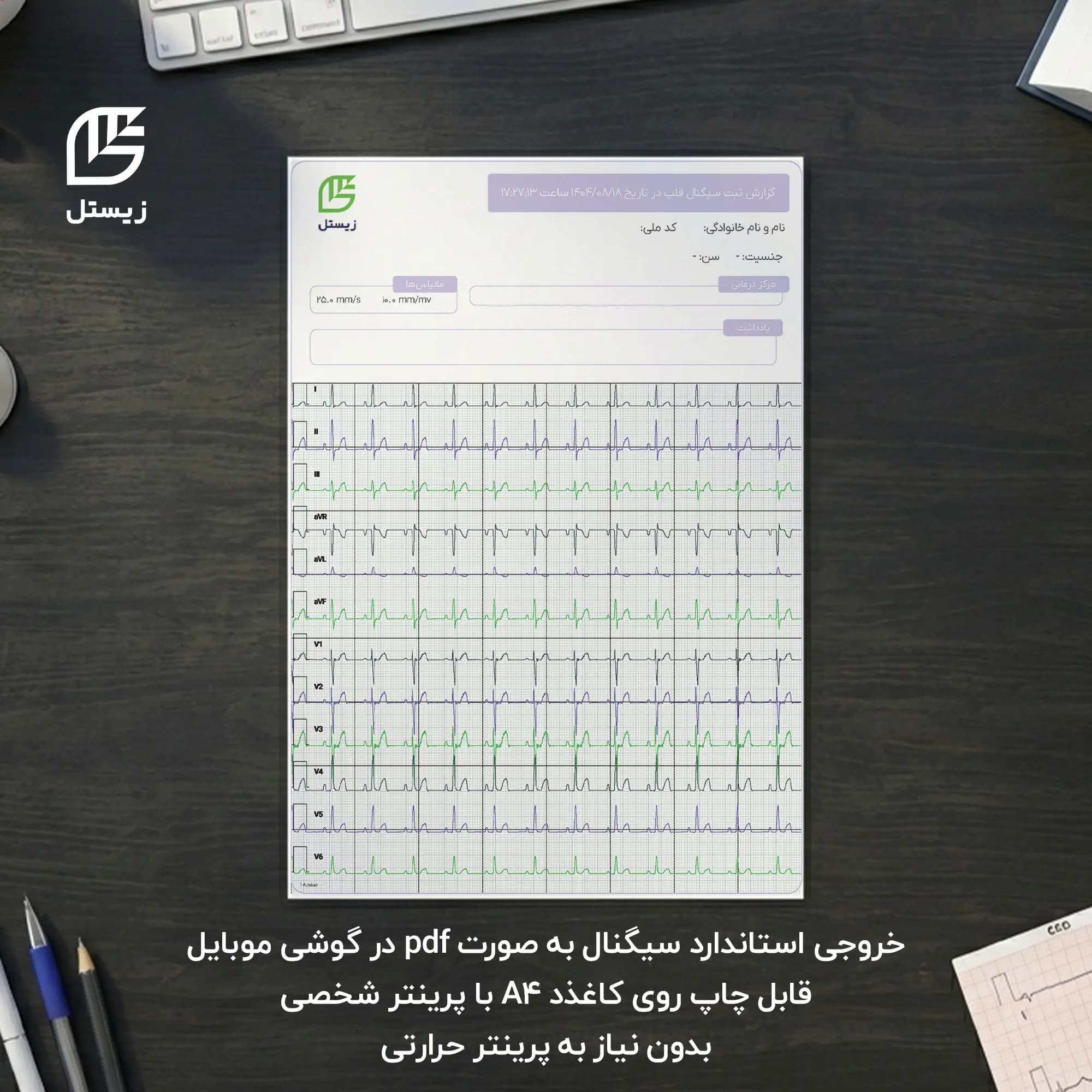 دستگاه نوار قلب 12 کانال قابل حمل زیستل مدل N-HEC1 — تصویر ۱۱