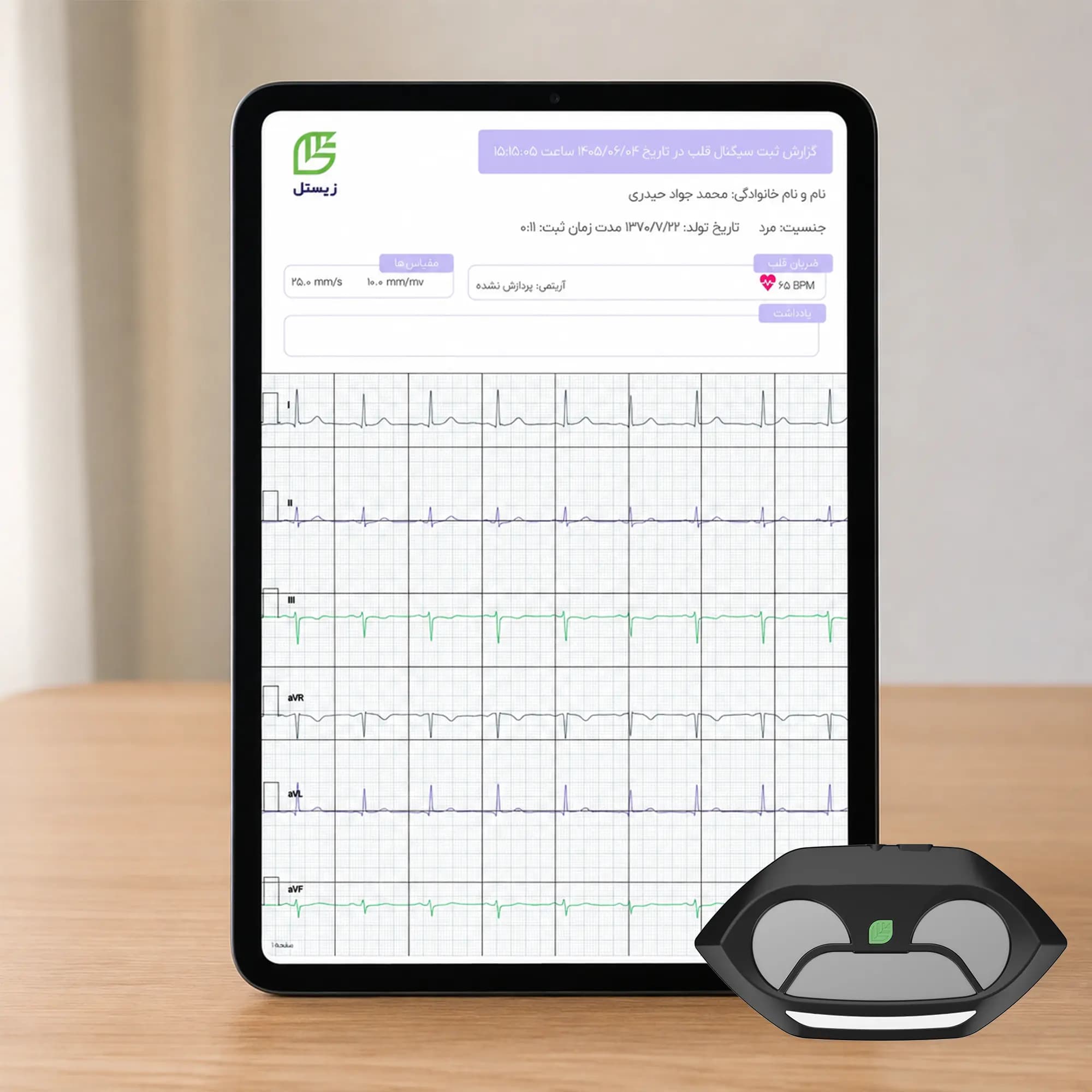 دستگاه ثبت نوار قلب شش لید زیستل (ECG) مدل N-PEC1 — تصویر ۳