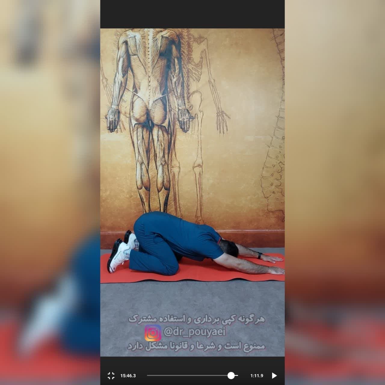دوره درمان تنگی کانال نخاع دکتر پویایی — تصویر ۹