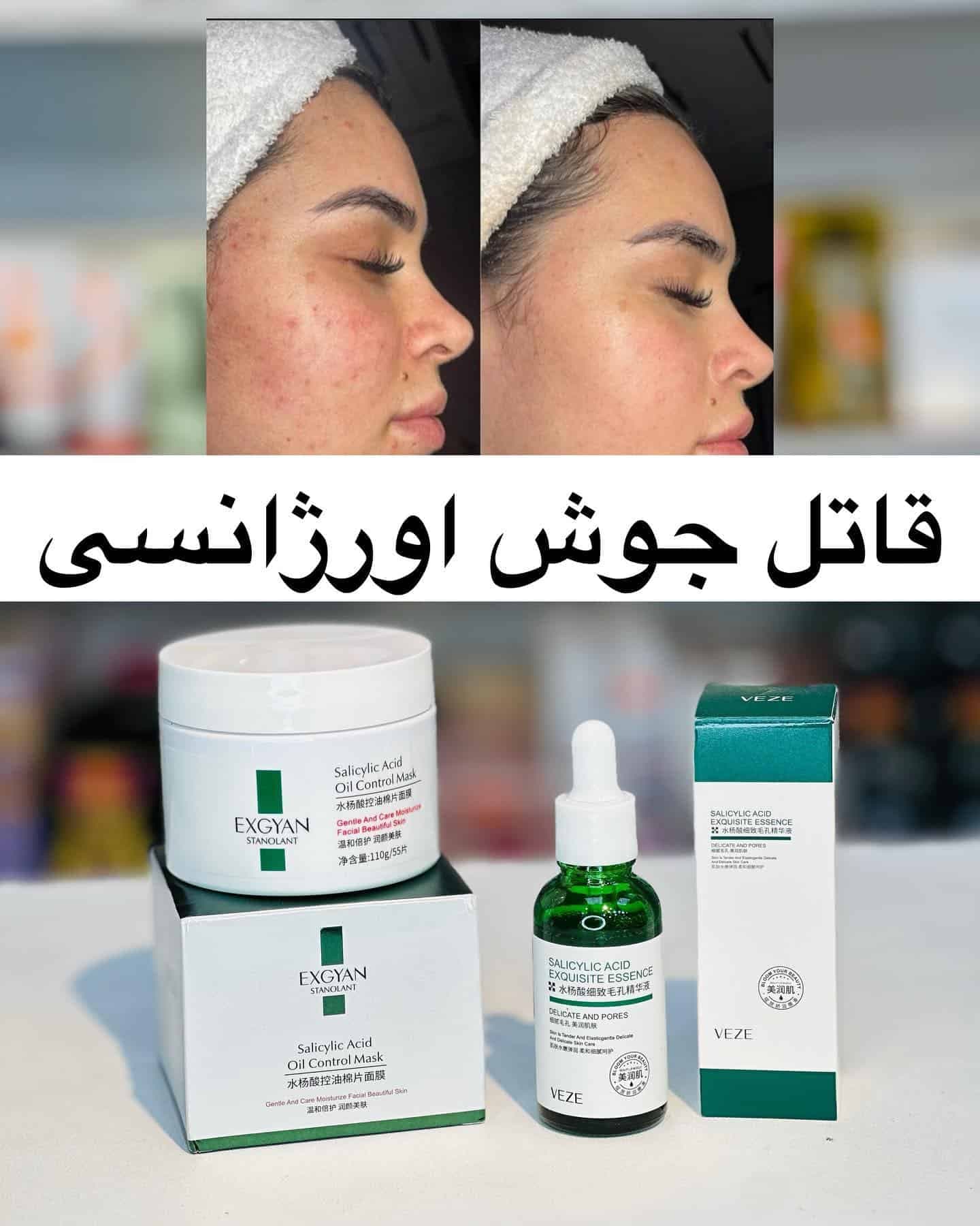 پک‌های ضد جوش سالیسیلیک اسید — تصویر ۴