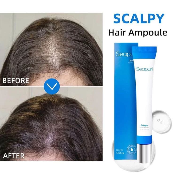 سرم ضد ریزش و تقویت ریشه سیپوری Sipory Hair Growth & Anti Hair Loss Serum — تصویر ۹