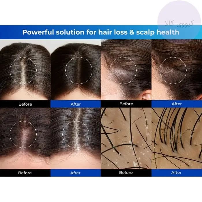 سرم ضد ریزش و تقویت ریشه سیپوری Sipory Hair Growth & Anti Hair Loss Serum — تصویر ۸