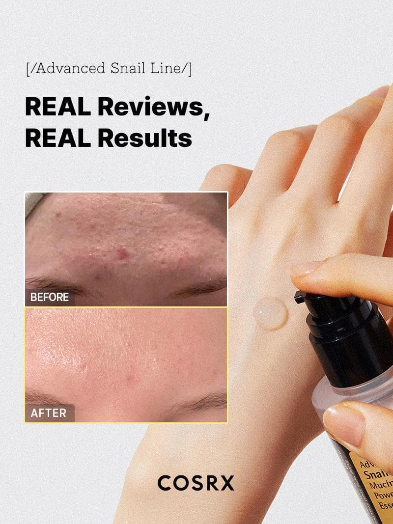 اسنس حلزون کوزارکس COSRX Advanced Snail 96 Mucin Power Essence — تصویر ۴