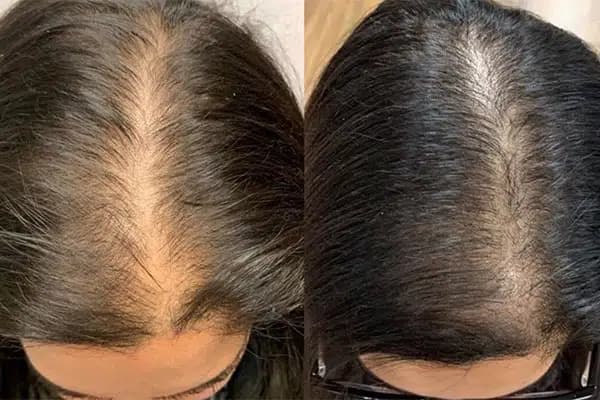بیوتین + بپانتن بایر Bayer Biotin + Bepanthen Ampoules — تصویر ۶