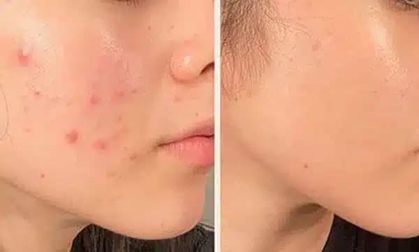 شوینده تی‌تری فارماسی Farmasi Tea Tree Face Wash — تصویر ۷