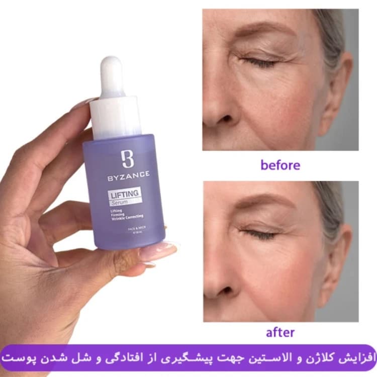 سرم لیفتینگ بیزانس شبه بوتاکس — تصویر ۲