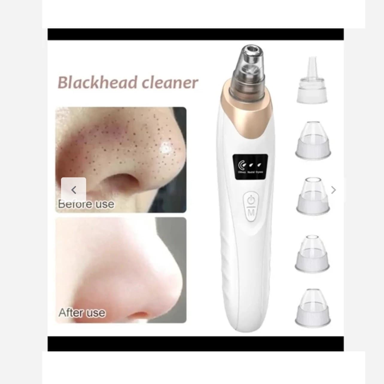 دستگاه میکرودرم پاکسازی صورت — تصویر ۴