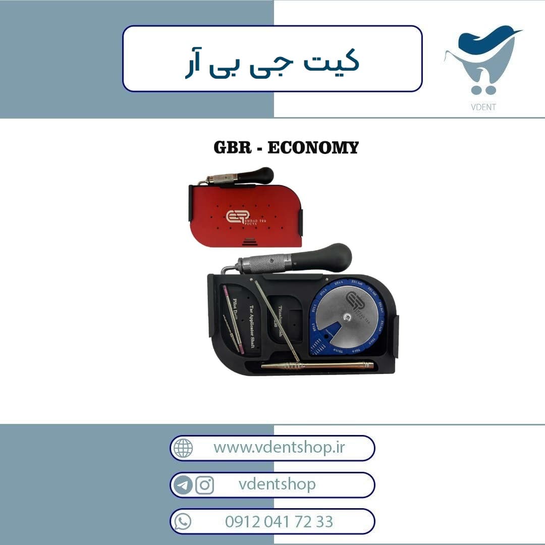 کیت جی بی آر GBR اقتصادی