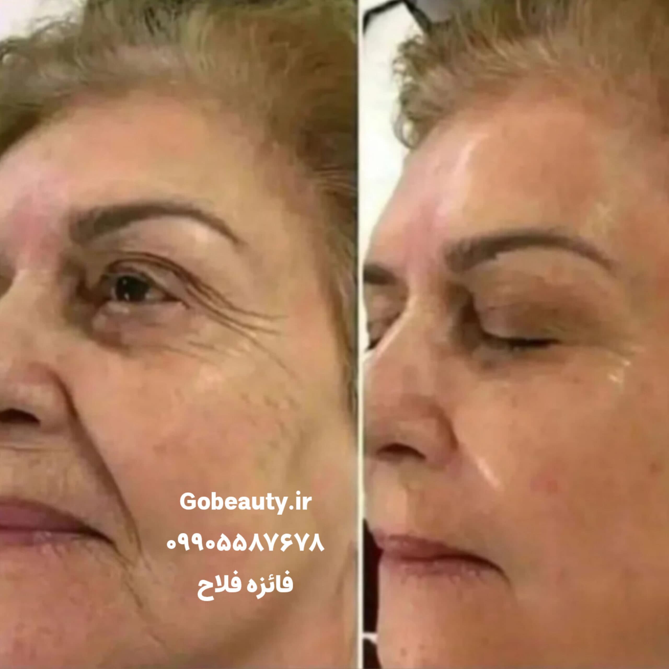 سرم سه گانه هوشمند تراست اسمارت — تصویر ۱۰