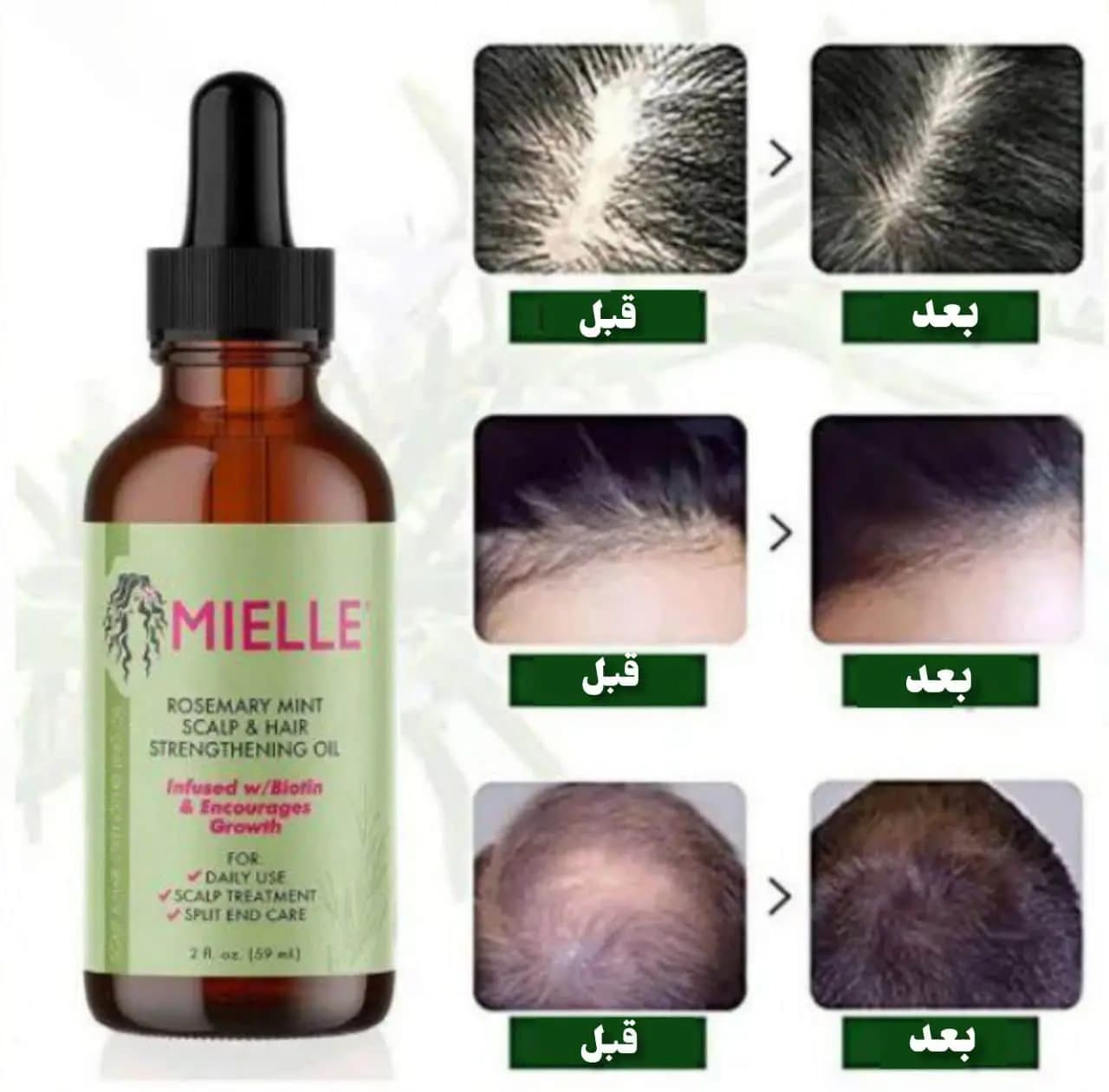 روغن ضد ریزش مو رزماری و نعناع میله 59 میل اورجینال — تصویر ۴