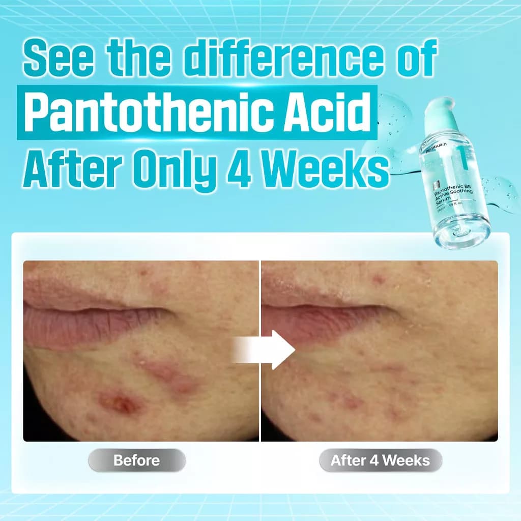 سرم آبرسان و نرم کننده پوست نامبوزین حاوی PANTOTHENIC B5 — تصویر ۴