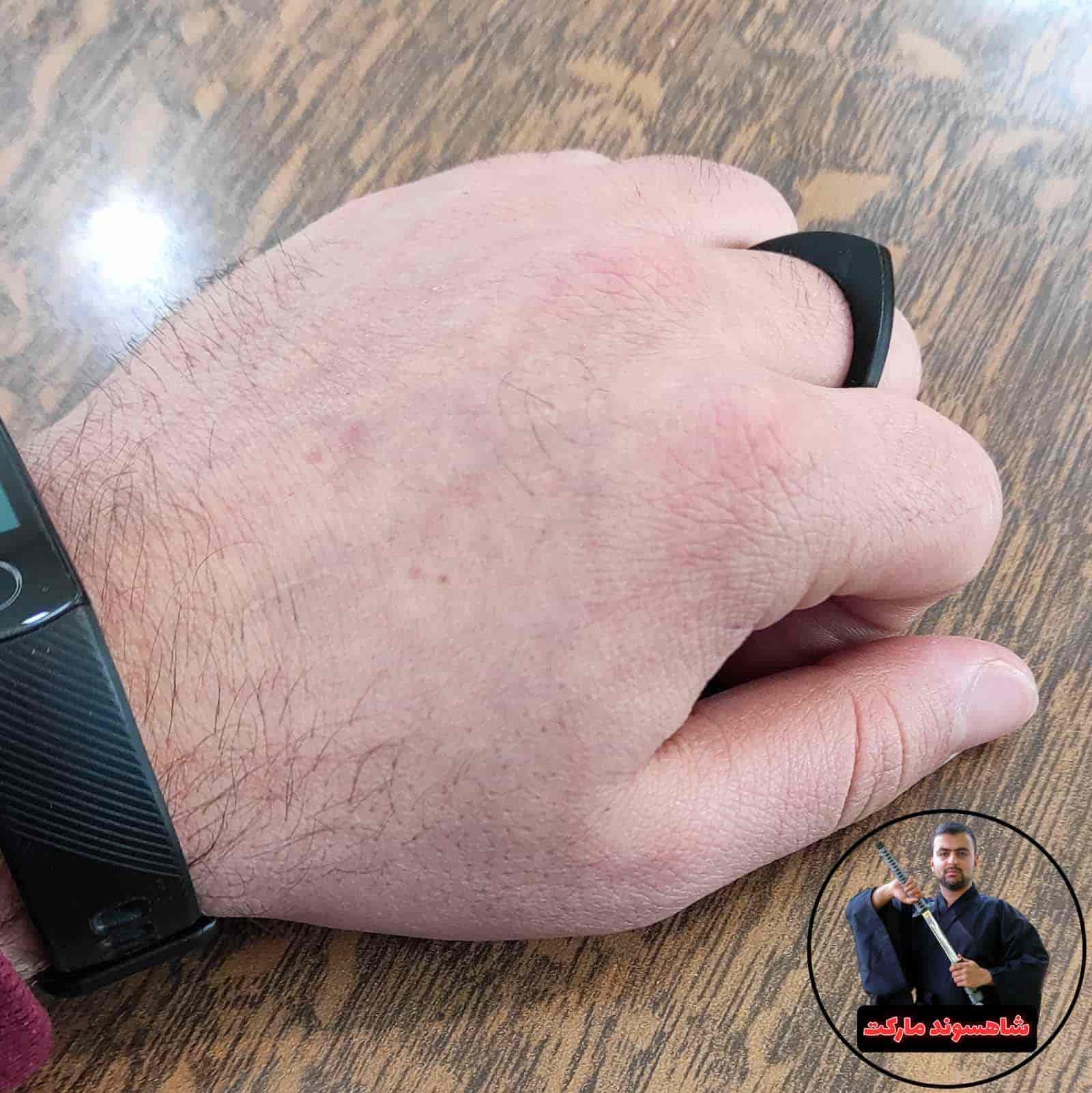 انگشتر کاکوته و نکوته — تصویر ۶